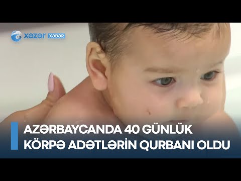 Azərbaycanda 40 günlük körpə adətlərin qurbanı oldu